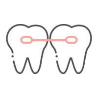 ブリッジ治療のイラスト画像